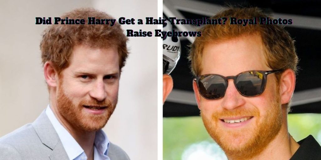 Did Prince Harry Get a Hair Transplant? Royal Photos Raise Eyebrows