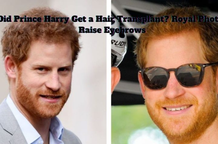 Did Prince Harry Get a Hair Transplant? Royal Photos Raise Eyebrows