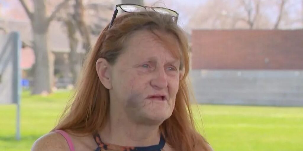 Dog Attack Leaves Utah Woman With Severe Injuries, Daughter Calls for Greater Awareness